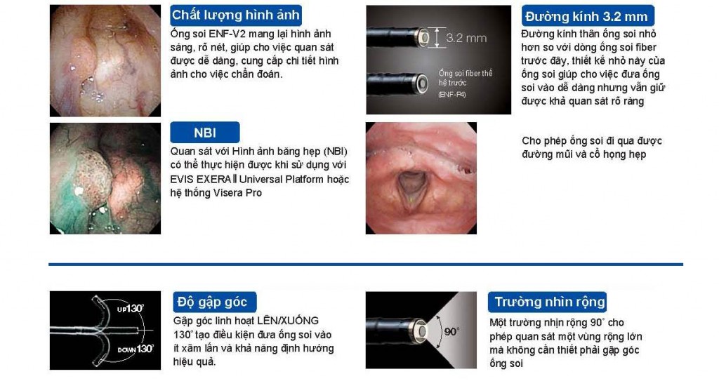 news-COMPREHENSIVE NASOPHARYNX CANCER