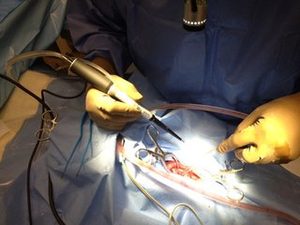 Advanced treatment for liver cancer