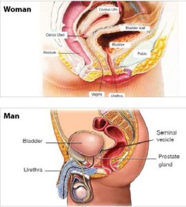 Abdomino Pelvic Radiotherapy