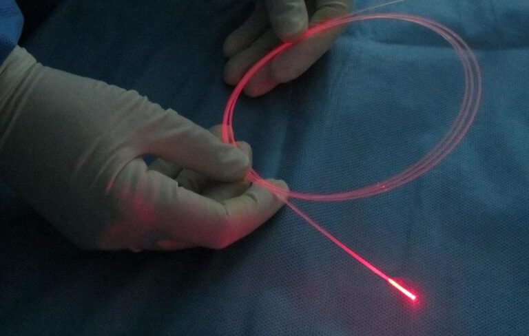 Endovenous laser via ELVeS Radial™ system – a unique solution for varicose vein treatment