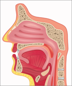Nasopharyngeal Carcinoma