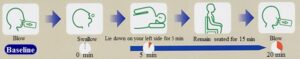 13C-UREA Breath Test