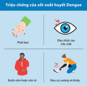 Sốt xuất huyết Dengue