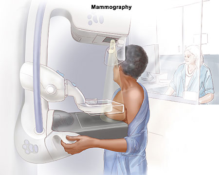 MAMMOGRAPHY - FV Hospital