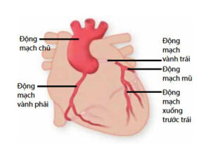 Chụp và Nong Mạch Vành (Can Thiệp Mạch Vành Qua Da)