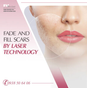 Fade and Fill Scars by Laser Technology at FV Skin & Laser Clinic