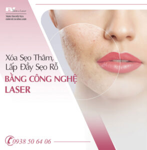 Xóa sẹo thâm, lấp đầy sẹo rỗ với công nghệ laser tại Trung tâm điều trị & chăm sóc da bằng laser FV
