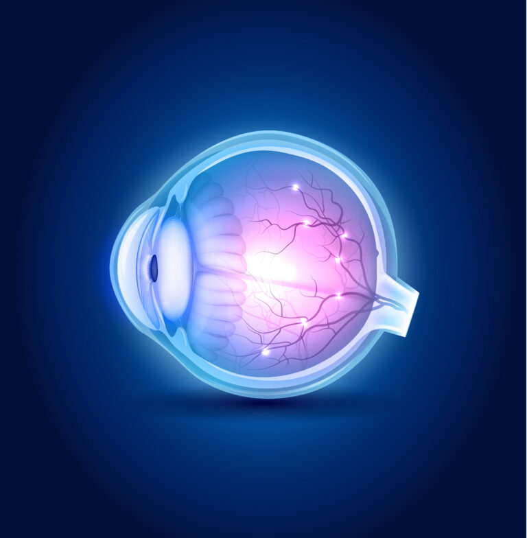 Intravitreal injections