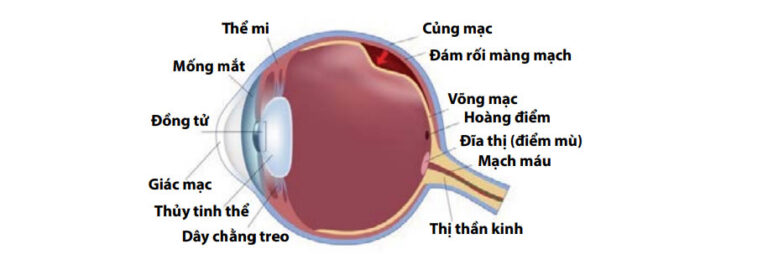 Tiêm thuốc nội nhãn