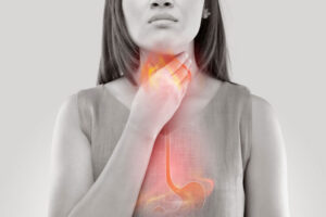 Barrett’s oesophagus treatment via Argon Plasma at FV Hospital