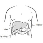 Phẫu thuật cắt gan