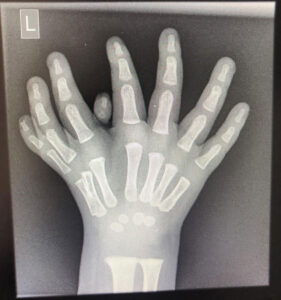 ‘Hand surgery magician’ Stéphane Guero: transforming hands, transforming futures