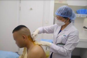 Treatment of Neck and Shoulder Pain by Thread Implantation