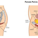 Bowel and Bladder Preparation for Radiotherapy to the Pelvis