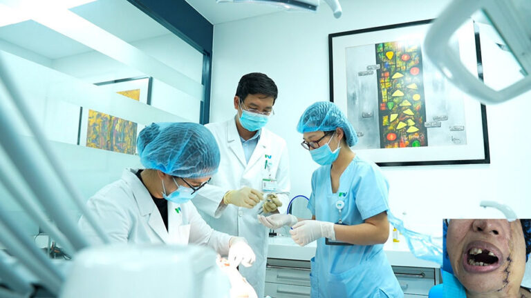 Bỏng lò than, người Phụ nữ… không thể mở miệng, ăn uống suốt 23 năm