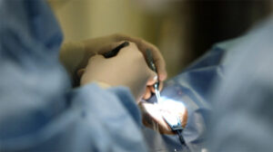 A 5-Year-Old Boy’s Vision Reduced to 1/10 Due to an Eye Condition Commonly Found in the Elderly