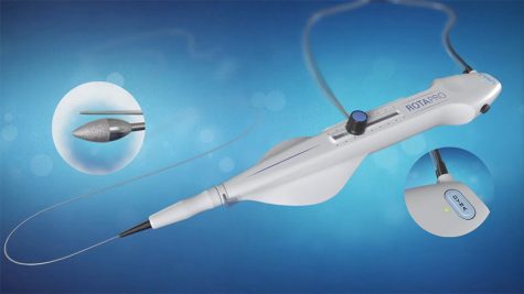 FV Hospital uses diamond drill to treat calcified coronary artery for ...