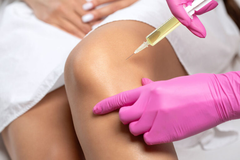 Platelet-Rich Plasma (PRP) Therapy