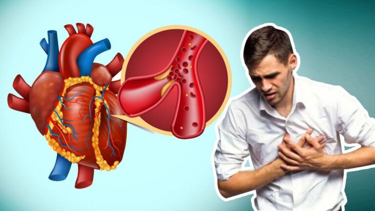 Bệnh tim mạch là gì? Vì sao bệnh tim mạch ngày càng trẻ hóa?