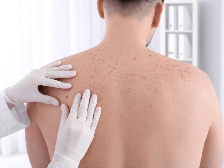 Tầm soát ung thư định kỳ – Giải pháp sàng lọc sớm các dấu hiệu ung thư