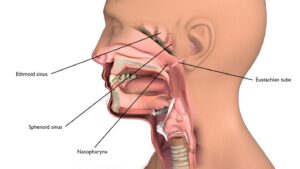 Bác sĩ liệt kê những dấu hiệu của ung thư vòm họng ít ai biết