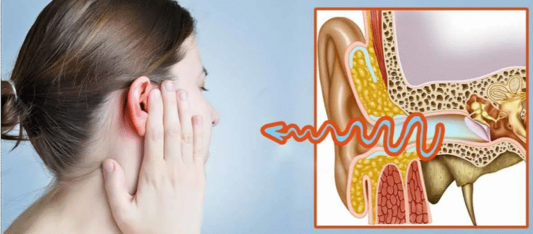 Hình ảnh viêm tai giữa ở người lớn và dấu hiệu dễ nhận biết