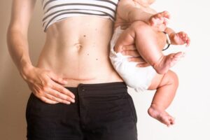 Sinh mổ được mấy lần là tối đa? Những thông tin quan trọng phụ nữ cần biết
