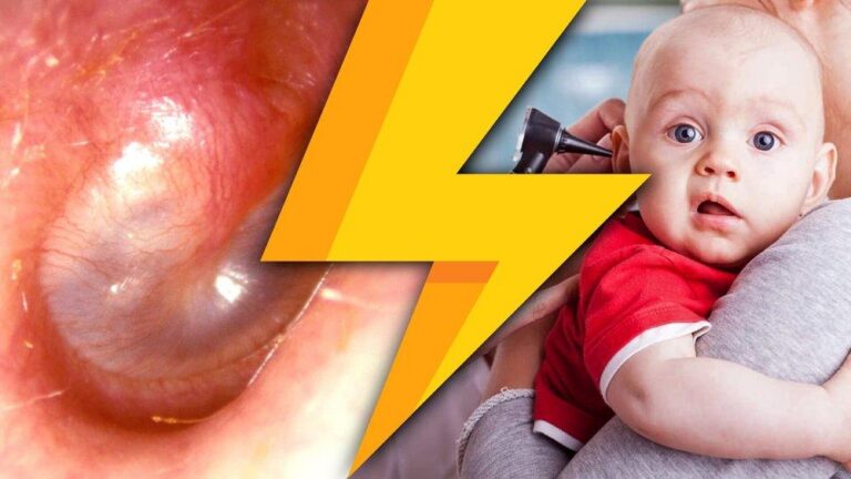 Bé bị viêm tai giữa: Nhận biết triệu chứng và hướng điều trị hiệu quả, an toàn