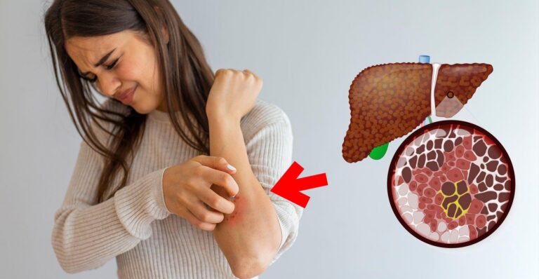 Biểu hiện của bệnh gan như thế nào? Cách kiểm tra gan tại nhà