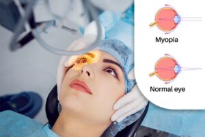 Sự thật về mổ mắt cận thị: Có chữa dứt điểm được không và nên thực hiện ở đâu để an toàn?