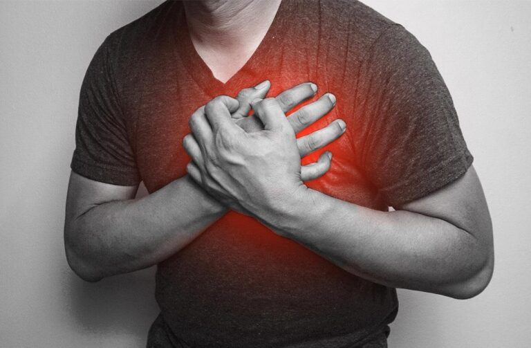 Nhồi máu cơ tim là gì? Những điều cần biết về rối loạn nhịp tim trong nhồi máu cơ tim