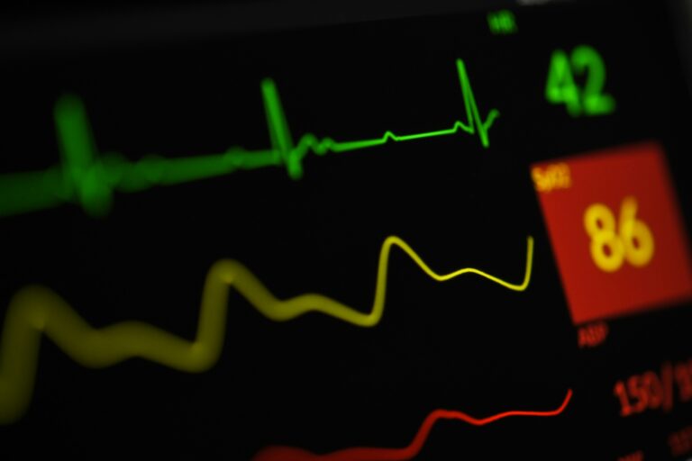 Abnormal Heartbeat (Arrhythmia)