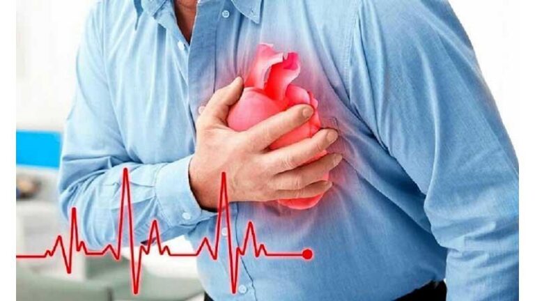 Bệnh Nhồi máu cơ tim cấp là gì? Nguyên nhân, dấu hiệu, chẩn đoán và điều trị
