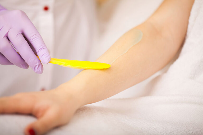 Triệt Lông Bằng Laser