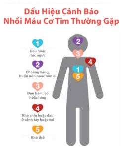 Dấu Hiệu Cảnh Báo Nhồi Máu Cơ Tim?