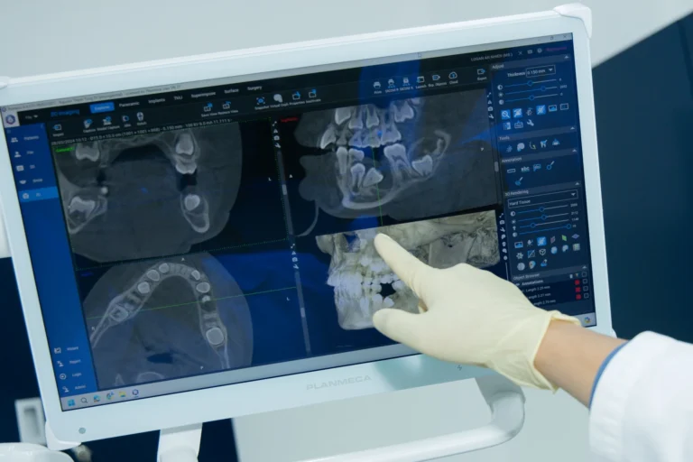 Oral & Maxillofacial Surgery