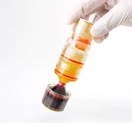 FV Hospital uses PRP to successfully treat hundreds of herniated disc cases without surger...