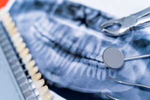 Dental Surgery