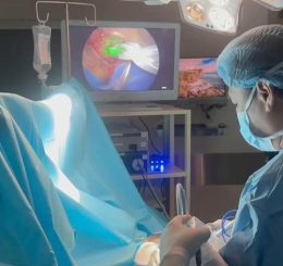 FV successfully implements sentinel lymph node biopsy (SLNB) using ICG fluorescence: A new...