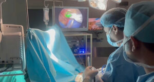 FV successfully implements sentinel lymph node biopsy (SLNB) using ICG fluorescence: A new step forward in breast cancer treatment