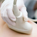 Ultrasound-Guided Breast Biopsy
